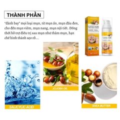 Gel Trị Mụn Nhanh - Hỗ Trợ Giảm Mụn Trong 3 Ngày, Kiểm Soát Dầu, Làm Mờ Vết Thâm Da - Sản Phẩm Cho Da Dầu, Da Dễ Nổi Mụn