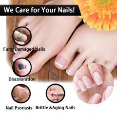 Serum Dưỡng Móng Eelhoe 30ml - Hỗ Trợ Loại Bỏ Nấm Móng, Cải Thiện Móng Hư Tổn, Dưỡng Chắc Khỏe Tự Nhiên