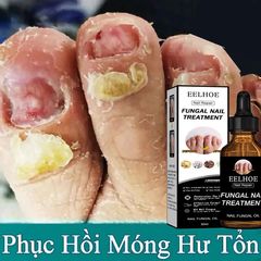 Serum Dưỡng Móng Eelhoe 30ml - Hỗ Trợ Loại Bỏ Nấm Móng, Cải Thiện Móng Hư Tổn, Dưỡng Chắc Khỏe Tự Nhiên