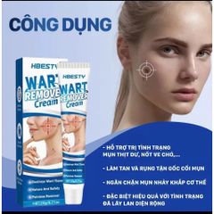 Kem Tẩy Nốt Ruồi & Lột Mụn Cóc 20g - Giải Pháp Hiệu Quả Cho Làn Da Mịn Màng, Dưỡng Ẩm Chuyên Sâu