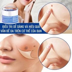 Kem Tẩy Nốt Ruồi & Lột Mụn Cóc 20g - Giải Pháp Hiệu Quả Cho Làn Da Mịn Màng, Dưỡng Ẩm Chuyên Sâu