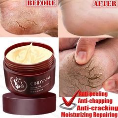 Foot care /Whitening repair foot cream Kem Bôi Ngựa Nứt Gót Chân Nẻ Tay Chân Á Sừng Bong Da Hiệu Quả/110g