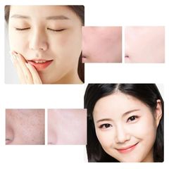 Kem Dưỡng Trắng Da, Hỗ Trợ Làm Mờ Thâm Nám & Đốm Nâu, Cho Da Sáng Đều Màu Rạng Rỡ