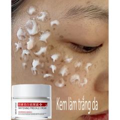 Kem Dưỡng Trắng Da, Hỗ Trợ Làm Mờ Thâm Nám & Đốm Nâu, Cho Da Sáng Đều Màu Rạng Rỡ