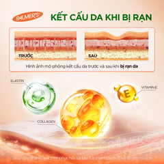 Lotion ngăn ngừa và hỗ trợ làm mờ rạn da cho mẹ bầu Palmer's 50ml 623334