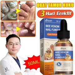 Tinh chất loại bỏ nấm móng Tinh chất bôi móng phục hồi giảm nấm 50ML