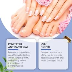 Tinh chất loại bỏ nấm móng Tinh chất bôi móng phục hồi giảm nấm 50ML