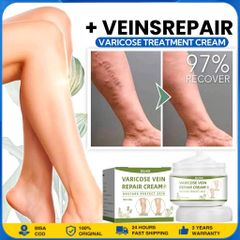  Kem suy giãn tĩnh mạch 50g giúp giảm đau mỏi tê phù chuột rút do suy giãn tĩnh mạch
