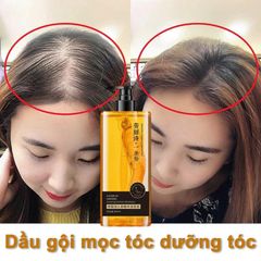 Dầu gội NHÂN SÂM tươi mọc tóc dầu gội chống rụng tóc300ml giảm rụng tóc Mọc Tóc Nhanh kiểm soát Làm mới và kiểm soát dầu