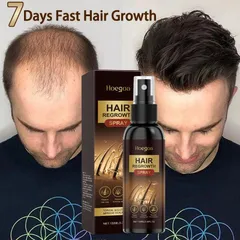 Xịt Kích Thích Mọc Tóc Nhanh 100ML- Phục Hồi Nang Tóc, Giảm Rụng Tóc