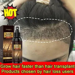 Xịt Kích Thích Mọc Tóc Nhanh 100ML- Phục Hồi Nang Tóc, Giảm Rụng Tóc