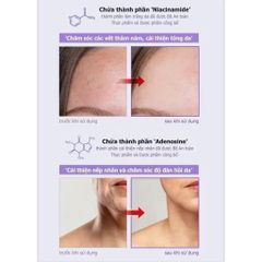 (CHÍNH HÃNG) Kem Dưỡng Da DLK Azulene Ampoule Cream Hỗ Trợ Phục Hồi Và Làm Dịu Da Nhạy Cảm - 50g