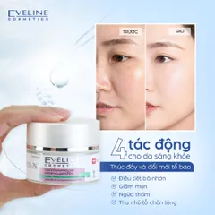 Kem dưỡng da ngừa mụn, giảm thâm mụn Eveline Glycol Therapy 50ml kiềm dầu tốt làm sáng da hiệu quả