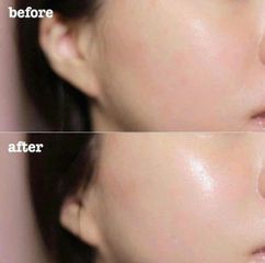 Kem Dưỡng Ẩm Clinique Moisture Surge 100H 50ml - Cấp Ẩm Sâu, Phục Hồi Da, Chăm Sóc Da Mặt Tuyệt Vời
