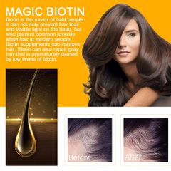 kích thích mọc tóc Xịt mọc tóc Giảm Gãy Rụng nơi rụng tóc Nhanh kiểm soát dầu loại bỏ gàu