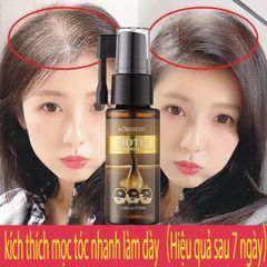 kích thích mọc tóc Xịt mọc tóc Giảm Gãy Rụng nơi rụng tóc Nhanh kiểm soát dầu loại bỏ gàu