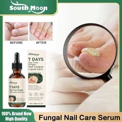 Serum Tẩy Nấm Móng Tay Chân Thảo Mộc Giúp Loại Bỏ Nấm, Kháng Khuẩn, Phục Hồi Móng Cứng Chắc Khỏe Tràm Trà & Gừng 7 DAYS
