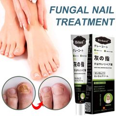 Kem bôi nấm móng tay Nhật Bản 20G