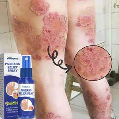 Xịt Bôi Nấm Ngứa Viêm Da Cơ Địa NHẬT BẢN Hắc Lào, Tổ Đỉa, Vẩy Nến, Á Sừng, Lang Ben Hiệu Quả