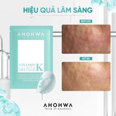 [5 miếng] Mặt nạ Ahohwa VITAMIN K SHEET MASK – PHỤC HỒI DA SAU XÂM LẤN phù hợp với mọi loại da