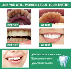 Bột Đánh Trắng Răng - Hạt Siêu Mịn Không Mòn Men - Cam Kết Trắng Bật Tông
