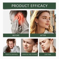 Dung dịch nhỏ tai giảm ù tai: Giải pháp thảo dược hỗ trợ giảm đau tai và tăng cường thính lực.