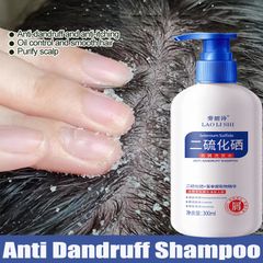 Dầu gội sạch gàu Dầu Gội gội loại bỏ mạt dầu gội giảm ngứa 300ml Làm sạch sâu da đầu, loại bỏ ve, loại