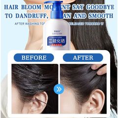 Dầu gội sạch gàu Dầu Gội gội loại bỏ mạt dầu gội giảm ngứa 300ml Làm sạch sâu da đầu, loại bỏ ve, loại