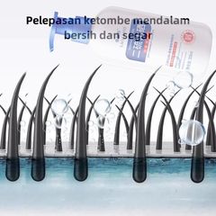 Dầu gội sạch gàu Dầu Gội gội loại bỏ mạt dầu gội giảm ngứa 300ml Làm sạch sâu da đầu, loại bỏ ve, loại