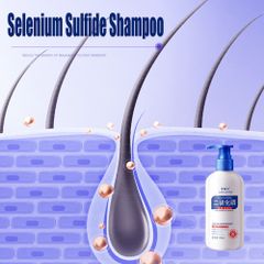 Dầu gội sạch gàu Dầu Gội gội loại bỏ mạt dầu gội giảm ngứa 300ml Làm sạch sâu da đầu, loại bỏ ve, loại