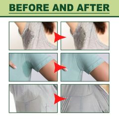 Kem Hôi Nách Chính Hãng - Khử Mùi Hôi Nách - Ngăn Tiết Mồ Hôi - Giảm Thâm-Underarm Deodorant Cream