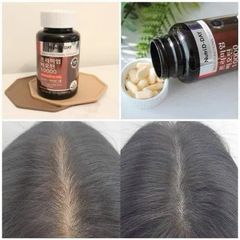 (Hàn Quốc) Viên Hỗ Trợ Mọc Tóc Giảm Rụng Tóc NUTRI D-DAY Premium Biotin 10000mg