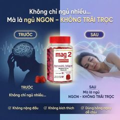 Viên Nhai Ngủ Ngon Mag2 Magnesium + Copper + Vitamin B6 45 Viên – Giảm Stress, Giảm mệt mỏi, bớt lo âu (date 11/2026)