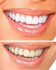 Set 3 Kem Đánh Răng Colgate Max Fresh – Hơi Thở Thơm Mát, Chăm Sóc Răng Miệng Tối Ưu, Sạch Khuẩn cho Gia Đình