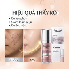 Serum Mờ Nám Đốm Nâu Sáng Da .Eucerin Ultrawhite+ Spotless Double Booster Serum 30ml
