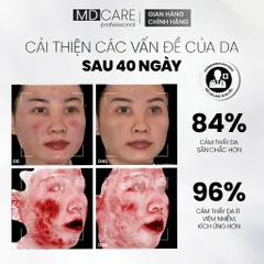 MD CARE NMF Prebiotics Serum 30ml Tinh Chất Cấp Ẩm Và Cân Bằng Hệ Vi Sinh Trên Da