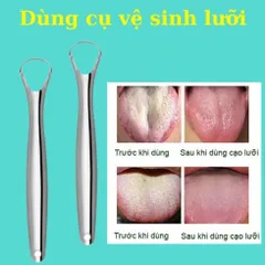 Bộ dụng cụ vệ sinh lưỡi bằng inox 304, làm sạch bề mặt lưỡi giúp hơi thở thơm mát dùng được cho trẻ nhỏ