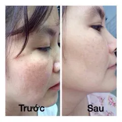 Viên uống Glutathion KD hỗ trợ trắng da,giảm nám,đồi mồi cho da (Hộp 30 viên)