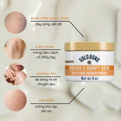 Kem dưỡng da body Gold Bond Ultimate Rough và Bumpy Skin 226g - Mỹ