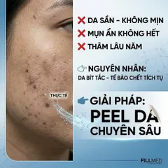 Mặt Nạ Tẩy Da Chết Fillmed Skin Perfusion Glyco Peel 500ml - Làm Sáng, Mịn Da, Cấp Ẩm Chuyên Nghiệp Từ Pháp