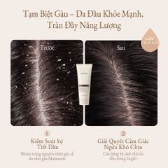 Youthology Gội Ngừa Gàu 200g – Kiểm Soát Dầu, Thơm Lâu, Da Đầu Sạch Khỏe