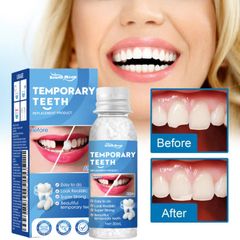 Keo Nhựa Răng Sửa Chữa Định Hình Răng, Keo Lắp Đầy Khoảng Trống Răng, Tạm Thời Sửa Chữa Răng Giả Keo An Toàn