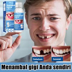 Keo Nhựa Răng Sửa Chữa Định Hình Răng, Keo Lắp Đầy Khoảng Trống Răng, Tạm Thời Sửa Chữa Răng Giả Keo An Toàn