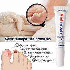 Serum Nấm Móng Tay Chân Hết Sạch Nấm, Bọng Móng, Hư Khoé, Nước Ăn Tay Chân, Dưỡng Cứng Móng