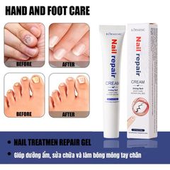 Serum Nấm Móng Tay Chân Hết Sạch Nấm, Bọng Móng, Hư Khoé, Nước Ăn Tay Chân, Dưỡng Cứng Móng