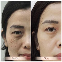 Extra Fish Collagen Hỗ trợ làm đẹp da,tóc,móng(Hộp 30viên)