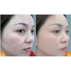 Viên Nội tiết tố Enternal Beauty sáng đẹp da,hỗ trợ tăng tiết nội tiết tố nữ(Hộp 30viên)