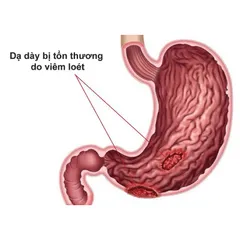 Viên uống Dạ Dày VShine hỗ trợ bảo vệ niêm mạc dạ dày(Hộp 50 viên)