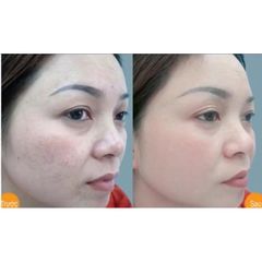 Viên uống Red vitamin E_Dầu thông đỏ giúp dưỡng ẩm da và giảm sạm da do lão hoá(Chai 30 viên)