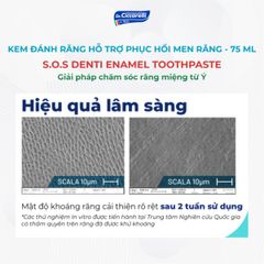 Kem đánh răng trắng răng, loại bỏ mảng bám Dr Ciccarelli S.O.S DENTI Whiteness Toothpaste 75 ml chính hãng